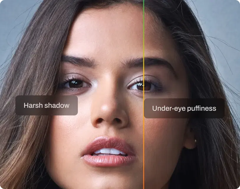 Selective Under-Eye Reduction
