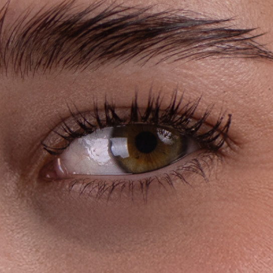 eyes after