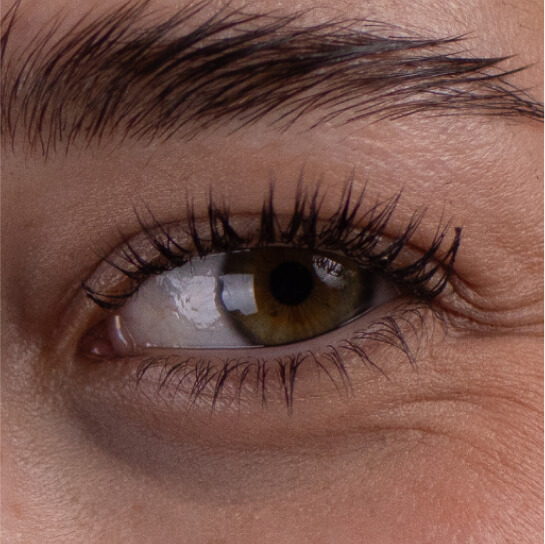 eyes before 1