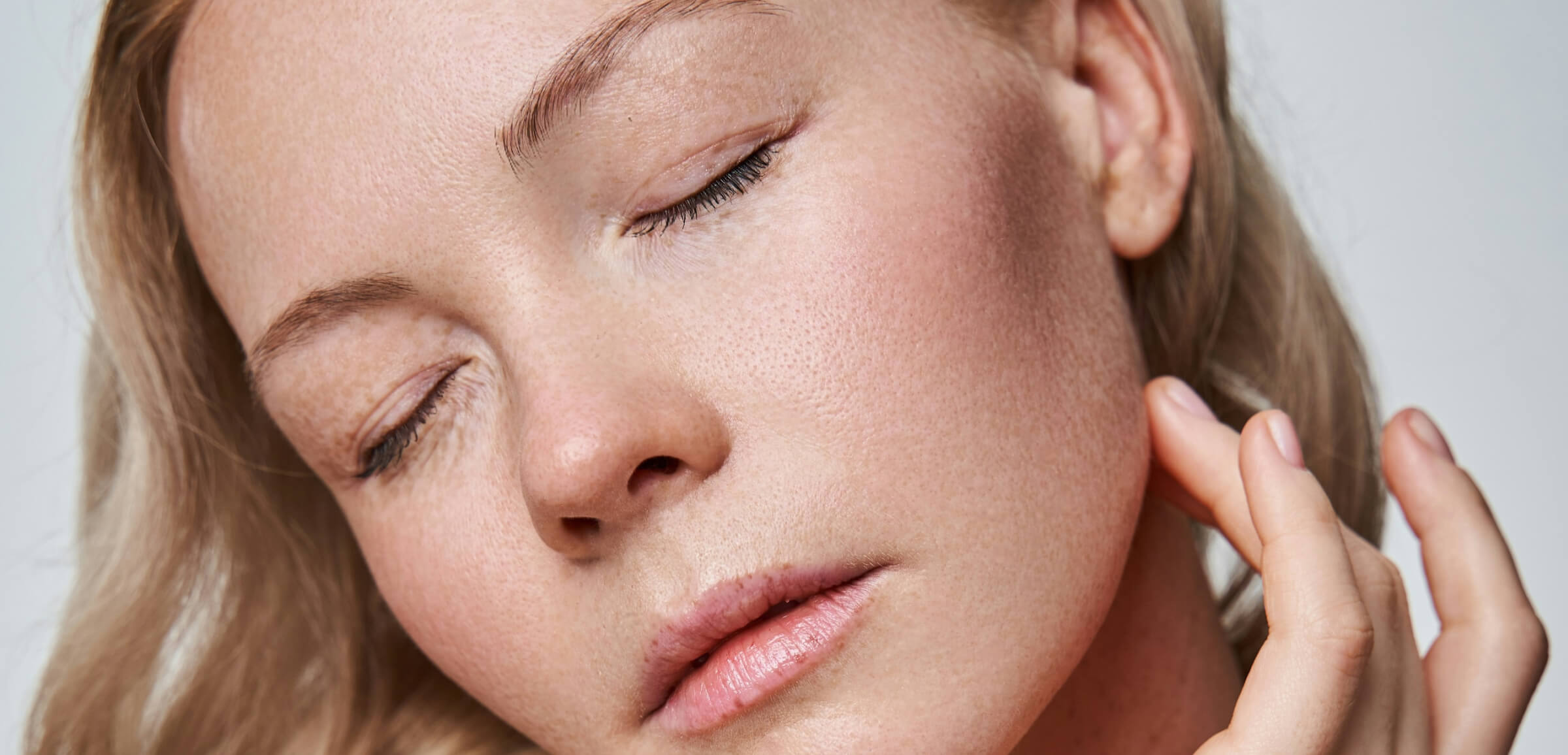 freckles removal after