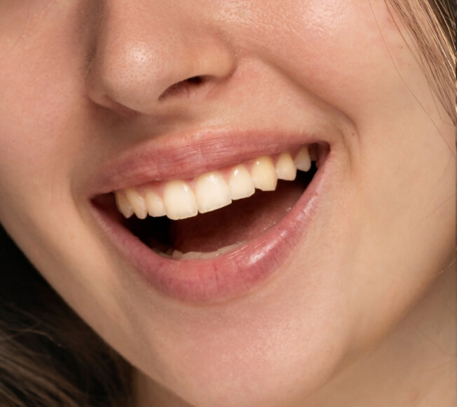 teeth after