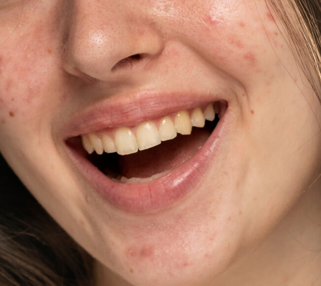 teeth before
