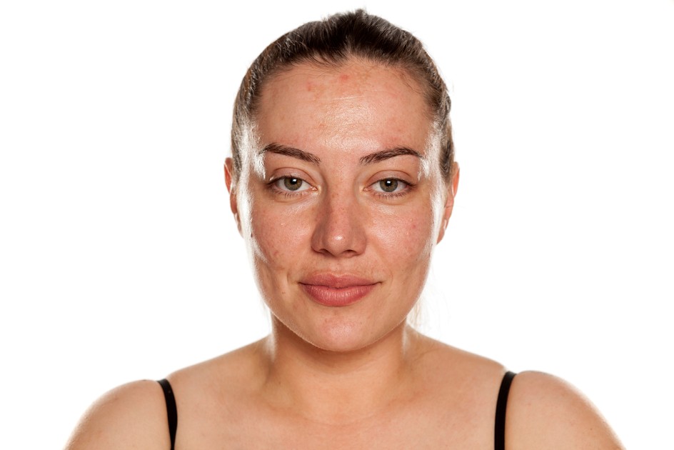 FACE before