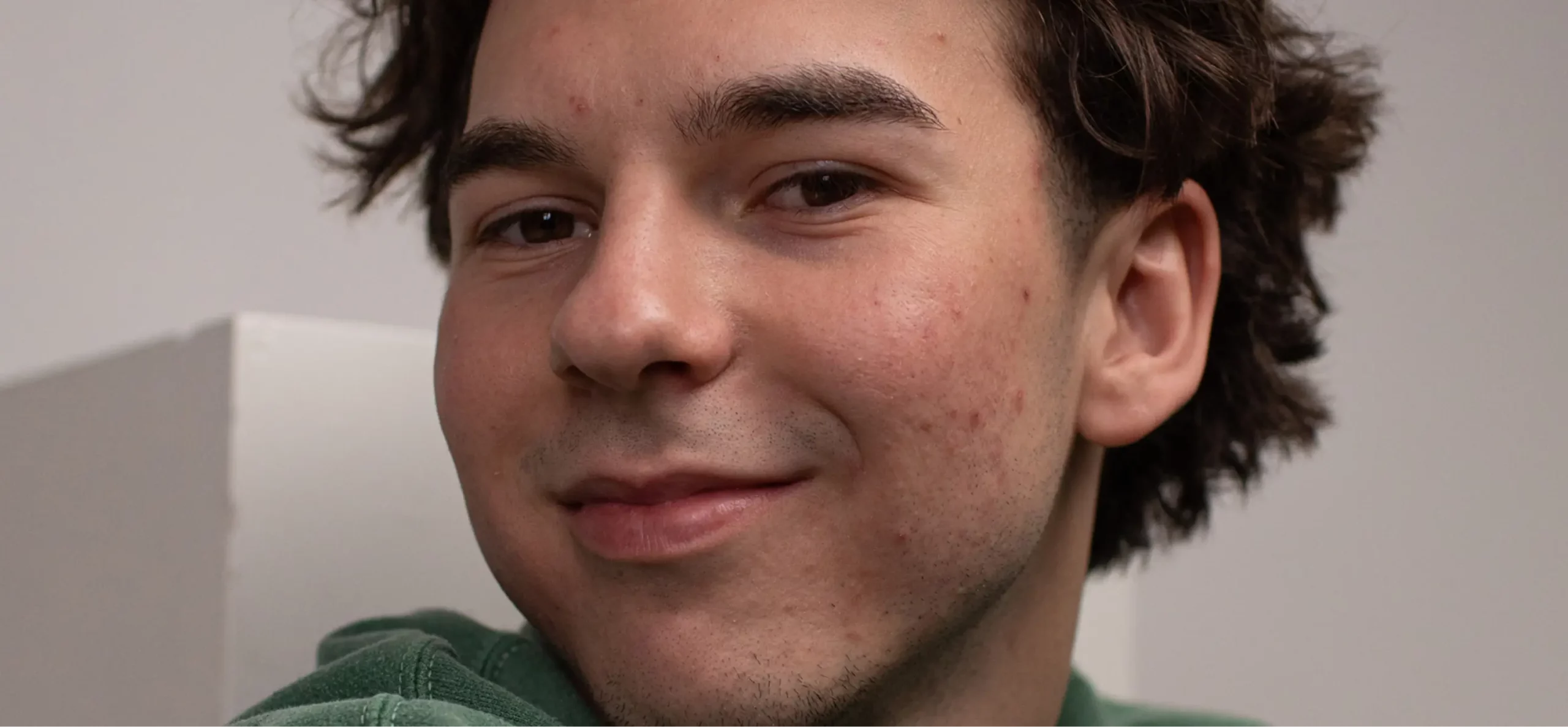 blemish removal before