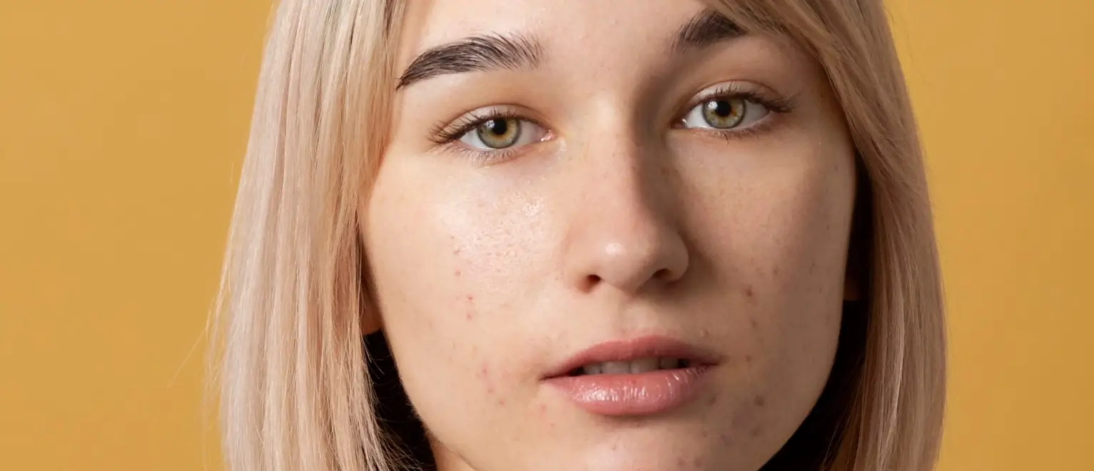 Blemish-Removal before