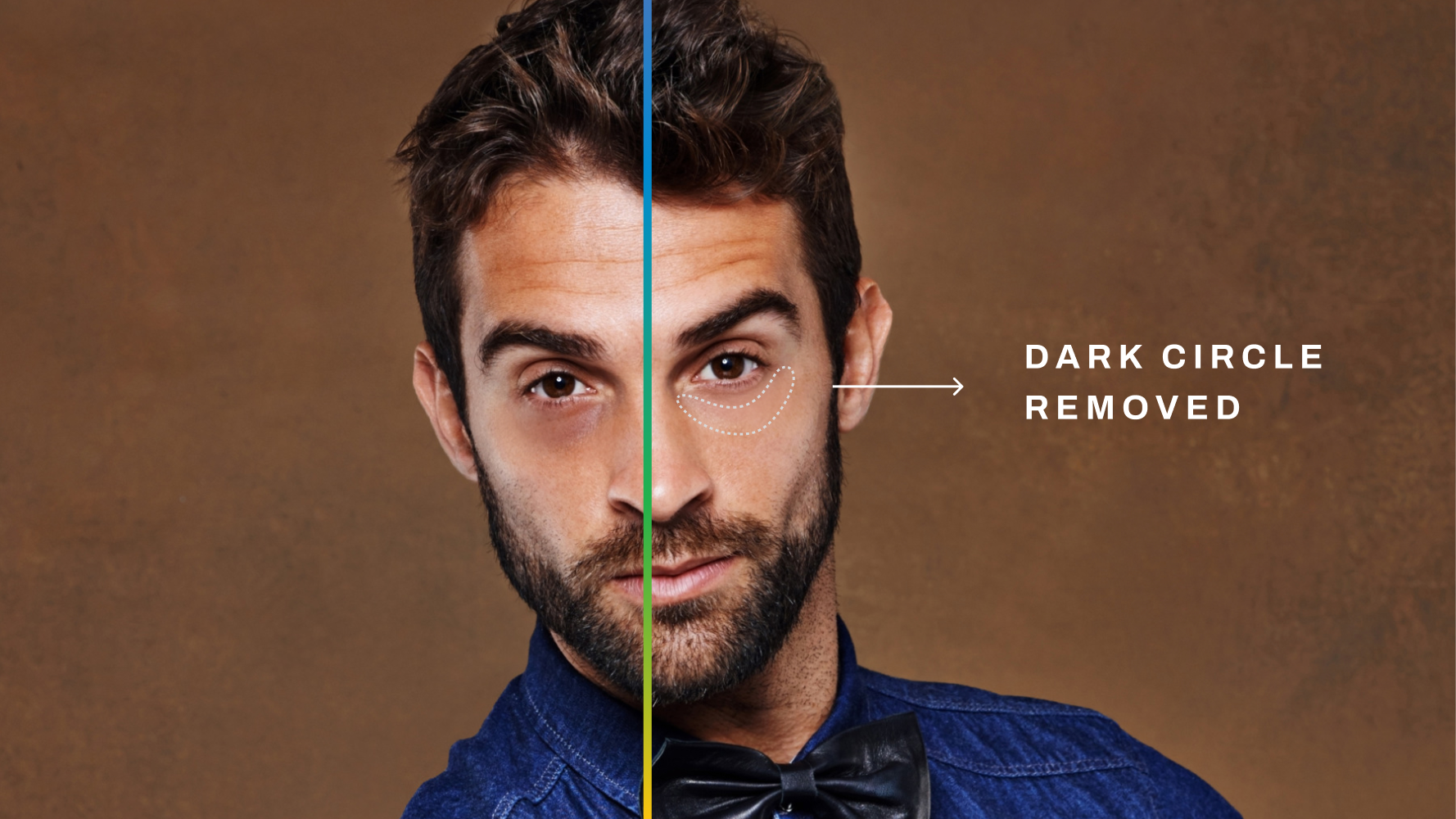 Aftershoot Dark Circle Remover